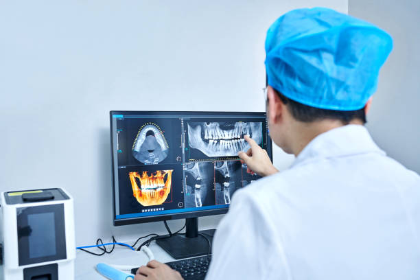 Best Emergency Tooth Extraction in Chapel Hill, NC