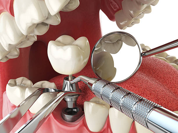 Best Pediatric Emergency Dentist in Chapel Hill, NC